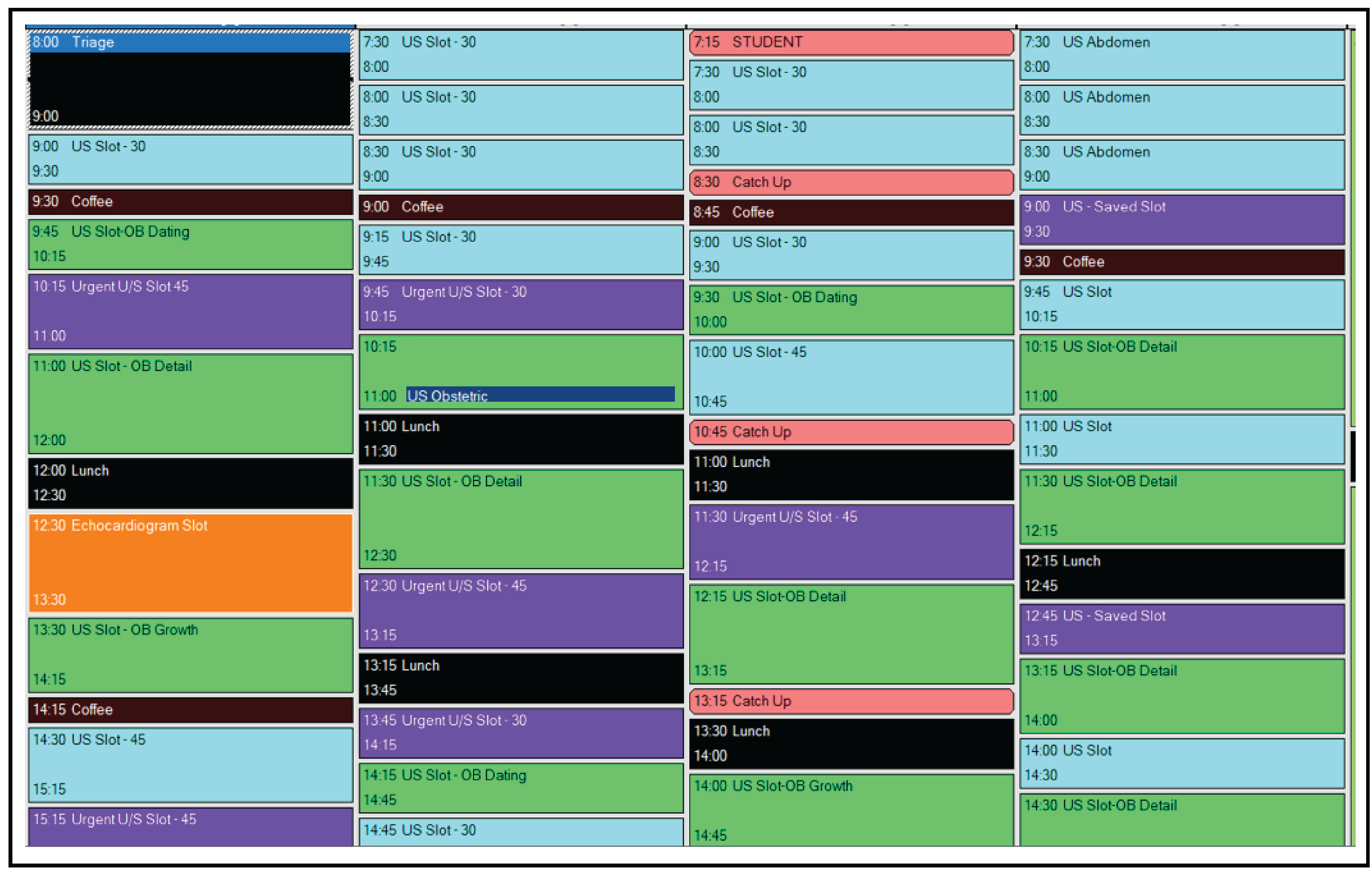 A table showing the standard number of ultrasound examinations scheduled during a typical 8-hour workday for 4 ultrasound rooms according to exam type, and included examinations for obstetrics, abdomen, echocardiogram, emergency, and others not identified. Time slots vary by 30-, 45-, and 60-minute increments.