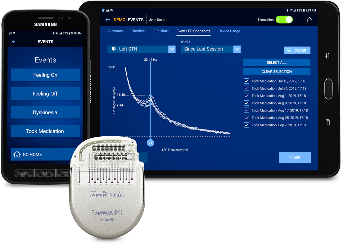 Image of the Percept PC Neurostimulator, with the user app open on a cell phone displaying the type of events a person with the implant can log, as well as an image of the event types as graphically displayed on a health care professional’s tablet.